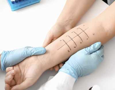 Comprehensive Allergy Testing