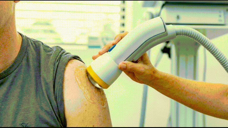 SoftWave Therapy