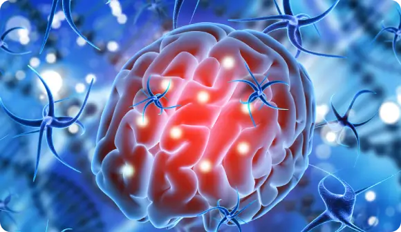 Cerebral inflammation and protein plaque accumulation contributing to anxiety in neurodegenerative diseases