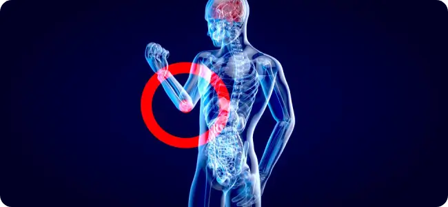 Anatomical visualization of persistent inflammatory and immune signaling dysregulation across multiple body systems, highlighting patterns of chronic and degenerative conditions.