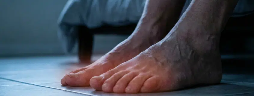 Close-up of bare feet on a floor in a dimly lit bedroom, representing the burning pain and sleepless nights caused by neuropathy.