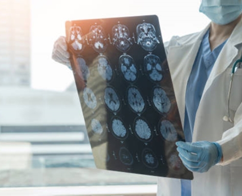 Treatment of Nerve Inflammation